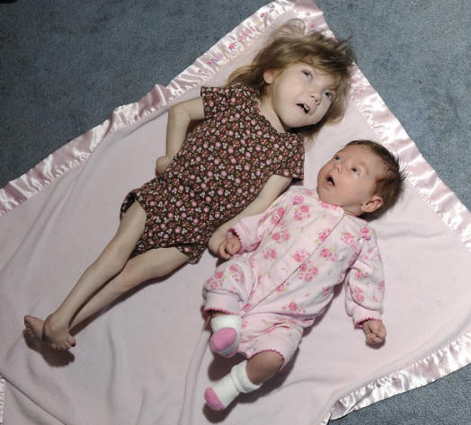 8-годишно момиче с бебешко тяло пази тайната на вечната младост