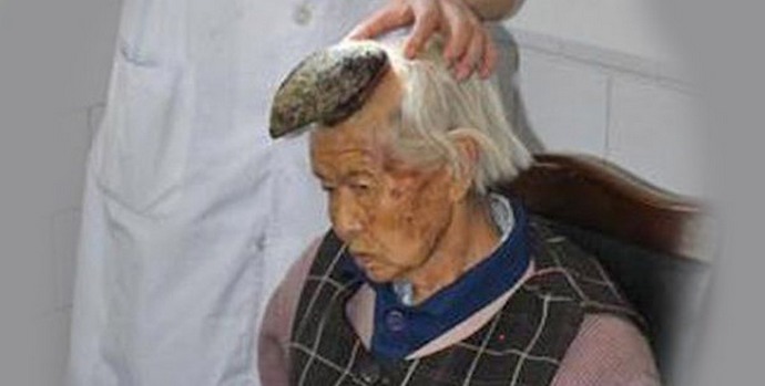 И рогата на главата растат при жените