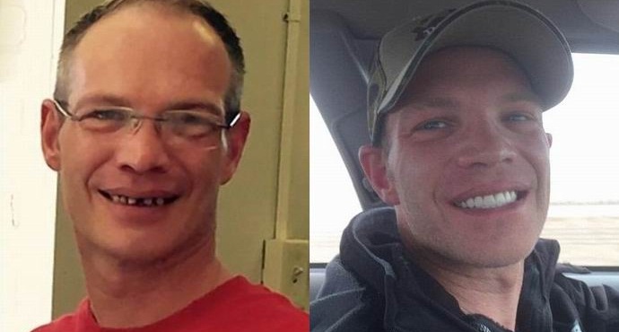 Американецът остави сервитьора двадесет и пет хиляди за стоматологично лечение