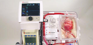 Австралийските лекари са се научили да трансплантират хора с мъртви сърца