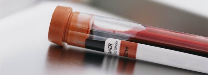 Човекът има тридесет и пет известни кръвни групи.