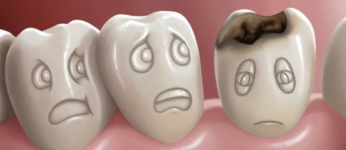 Два и половина милиарда земляни не искат да лекуват кариес