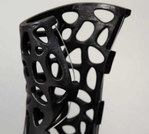 Ултразвуковият гипс ще излекува фрактурите с 80% по-бързо.