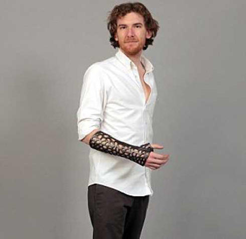 Ултразвуковият гипс ще излекува фрактурите с 80% по-бързо.