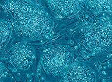 Холандските учени предлагат да нахранят целия свят с месо от стволови клетки