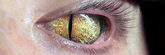 Синята кръв на влечугите. Как Обама се свързва с влечугите.