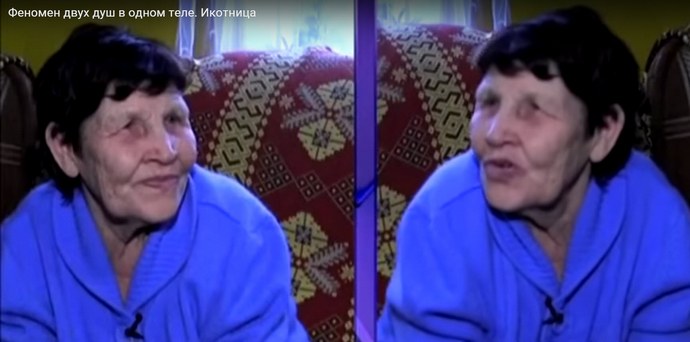 Икотница. Феноменът на живота на две души в едно тяло