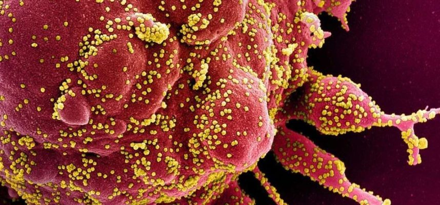 Проучване показва, че COVID-19 може да принуди имунните системи да се атакуват 