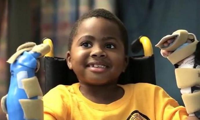 Момчето си възвърна ръцете