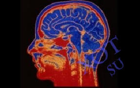 Мозъчните импланти ще помогнат на човек да работи по-ефективно.