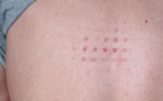 Откъде идват необичайните белези по тялото?