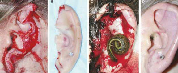 „Пиявиците