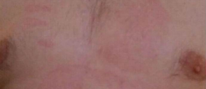 Полтергейст длан изгори гърдите на Новоросийск