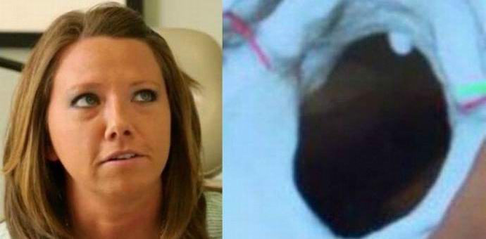 Рядко заболяване кара американец да чуе работата на тялото й.