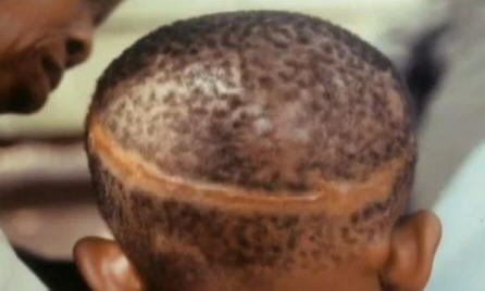 Рождените белези свързани ли са с насилствена смърт в минал живот?