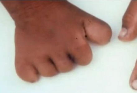 Рождените белези свързани ли са с насилствена смърт в минал живот?