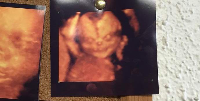 Моментна снимка