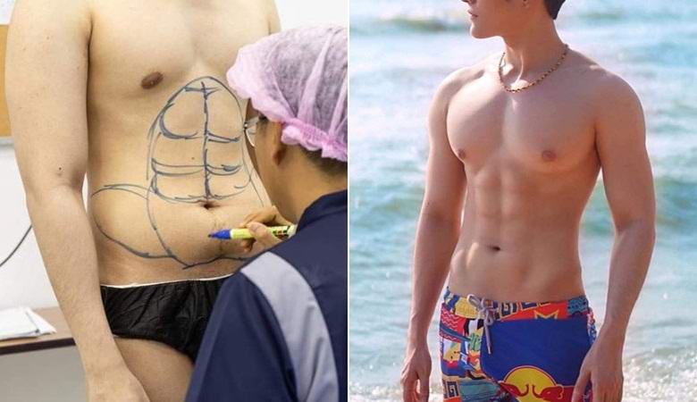 Тайландската болница дава на дебелите пациенти появата на надута преса