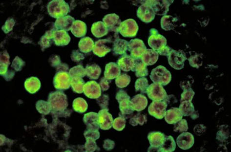 В Луизиана водата се замърсява от амебите, които ядат мозъка.