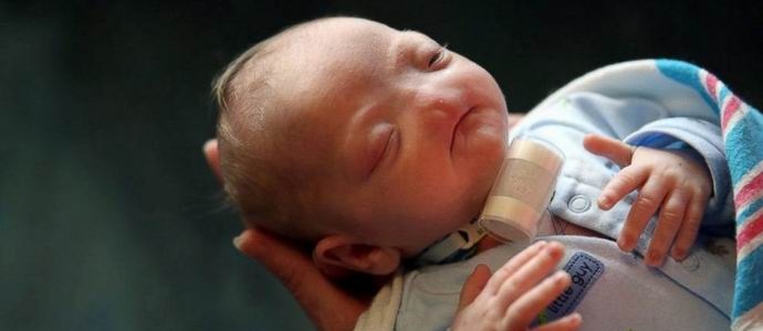 Дете с рядка аномалия се роди в САЩ