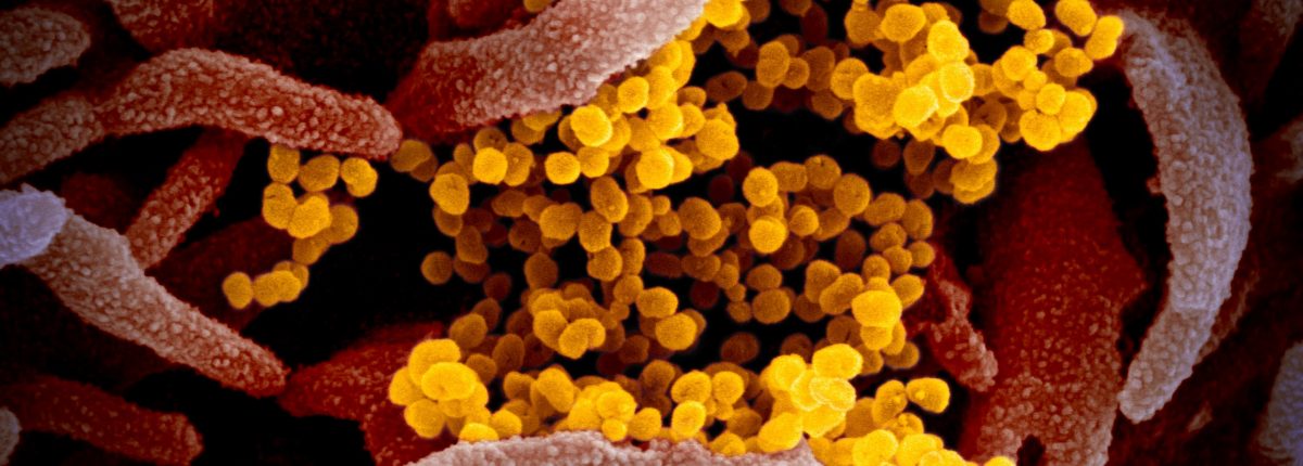 Ето как изглежда вирусът COVID-19 под микроскоп 