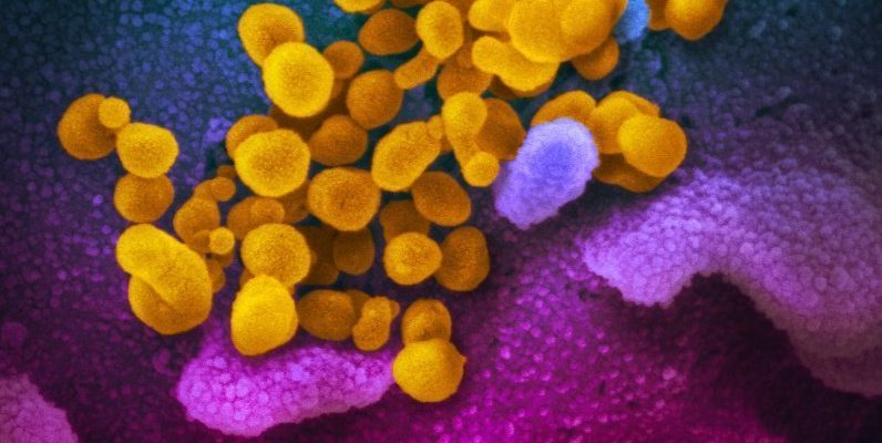 СЗО: Най-малко 70 варианта за ваксина срещу коронавирус вече са в процес на разработка 