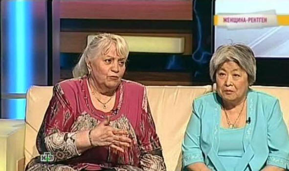 Юлия Воробьова - Невероятната рентгенова жена