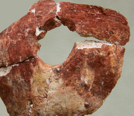 Защо преди шест хиляди години хирурзите направиха трепанация