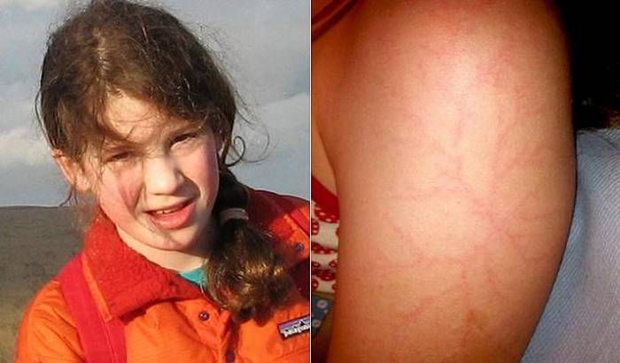 Тайнствени рисунки по кожата на руснаците